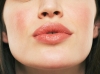 Бажаєте отримати ідеальну форму губ? Хейлопластика — найкраще рішення!
