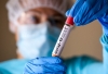 Біль та рожеві очі: на Рівненщині зафіксували новий підвид коронавірусу