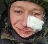 Лідера гурту «Бумбокс» поранили російські загарбники під час обстрілу