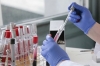 На Рівненщині – 36 нових хворих на коронавірус, без смертей