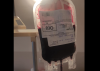Поліцейський став донором крові для рівнянки, яка терміново потребувала переливання 