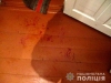 П’яний на Дубровиччині жорстоко побив палицею батька своєї співмешканки