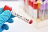 Рівненщина знову демонструє великий приріст хворих на коронавірус: 85 за півдоби