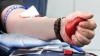 Рівнян закликають стати донорами крові