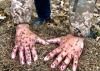 Руки в мурашник: екснардеп показав як лікувати застуду (ВІДЕО)