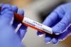 Тести на коронавірус на Рівненщині проводитиме ще одна лабораторія