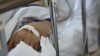 У лікарні в Рівному помер 280-кілограмовий пацієнт