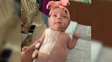 Унікальний випадок: немовляті з Рівного встановили порт-систему для хіміотерапії