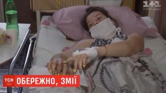 Напади гадюк на Рівненщині: у дівчини розпухла рука, а у чоловіка – нудота