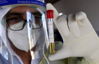 За день на Рівненщині підтвердили 21 новий випадок коронавірусу