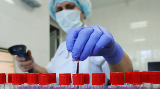 113 смертей і 5469 нових випадків коронавірусу за добу в Україні