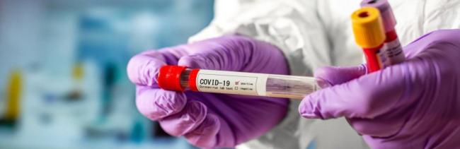 +29 нових випадків захворювання на COVID-19: найбільше у Вараші