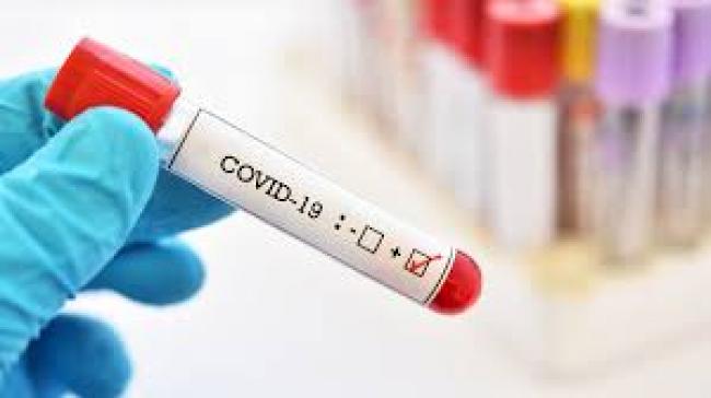 COVID-19 на Рівненщині: +141 хворий та дві смерті