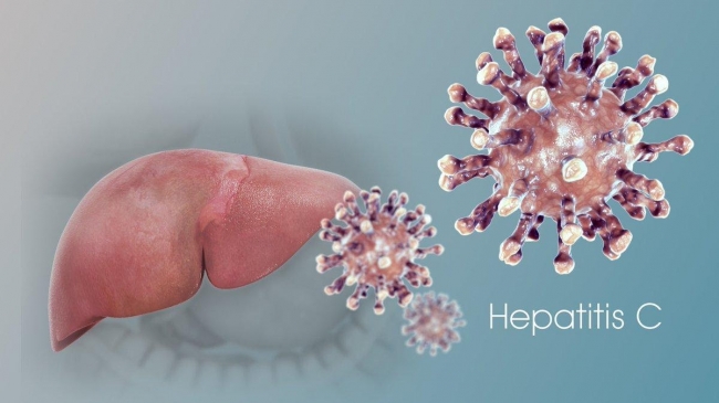 Какой гепатит может быть хроническим