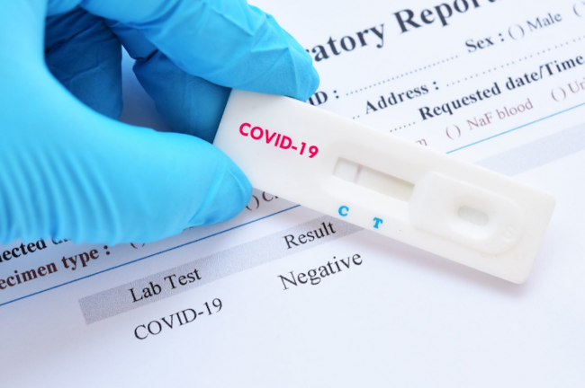 Кому робитимуть швидкі тести на антиген до COVID-19