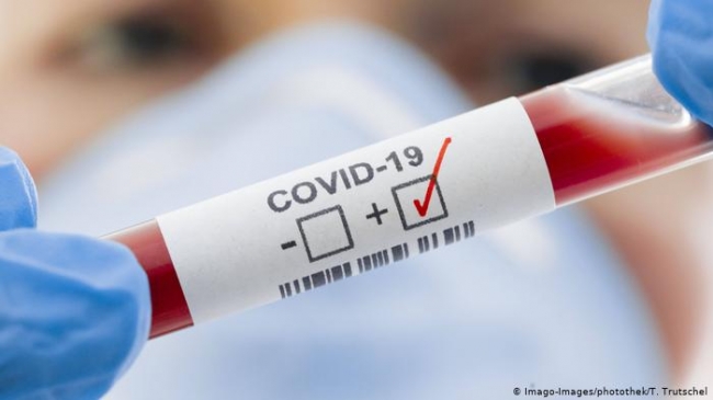 Коронавірус на Рівненщині: 10 смертей і 666 нових інфікованих