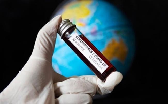 Коронавірус у світі забрав життя понад 900 тис. осіб