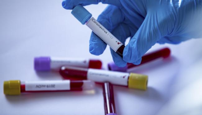 Лікарів та хворих на пневмонію тестуватимуть на коронавірус