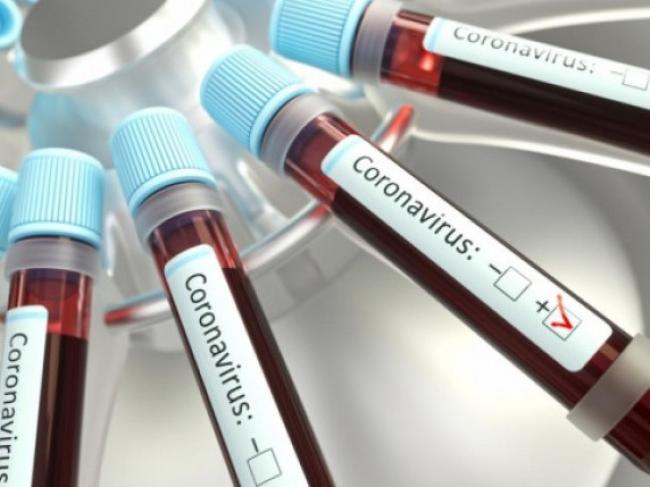 Лопавше: люди, які контактували з хворою на коронавірус жінкою, отримали результати обстеження
