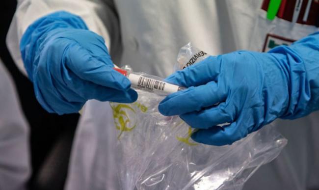На Рівненщині ще 12 хворих перевіряють на коронавірус