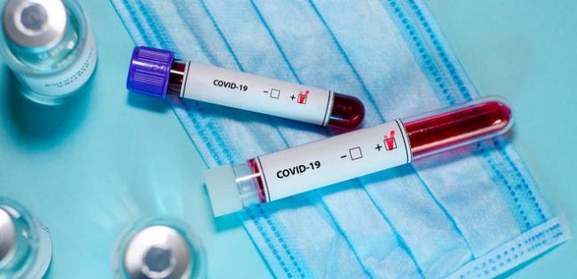 Понад 2,9 тис. випадків зараження COVID-19 за добу в Україні