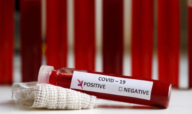 Понад 300 тисяч хворих на коронавірус – за минулу добу у світі