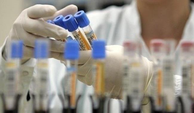 Понад 300 тисяч осіб в Україні заразилися коронавірусом