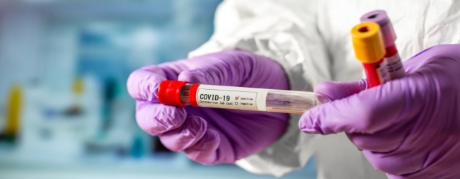 Сімейний лікар не дає направлення на безкоштовний тест на COVID-19: що робити 