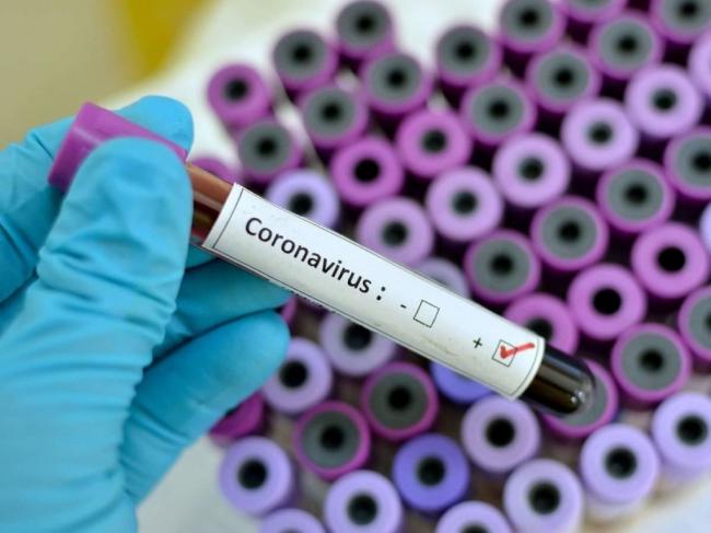 Сьогодні ввечері на Рівненщину надійдуть тест-системи на визначення коронавірусу
