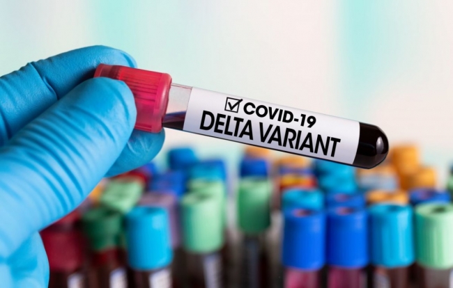 У пів десятка жителів Рівненщини виявили штам коронавірусу «Дельта»