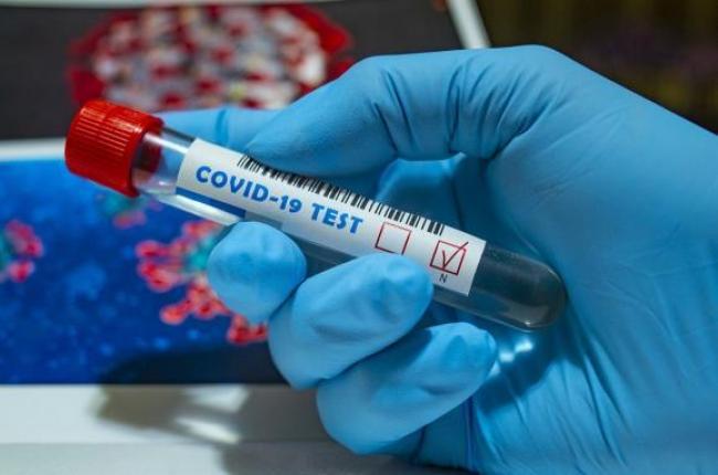 В Україні 5062 нових випадки коронавірусу 