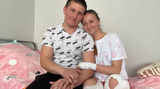 Одружилася медсестра з Лисичанська, яка через війну втратила ноги