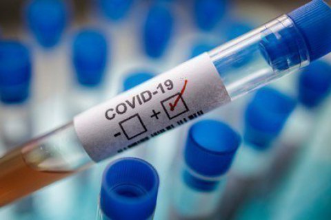 За добу на Рівненщині зафіксували 15 випадків COVID-19