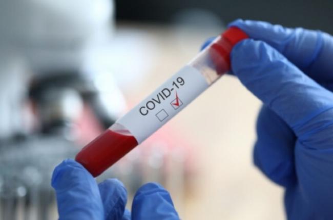 За попередню добу на Рівненщині зареєстровано 150 хворих з COVID-19 та дві смерті